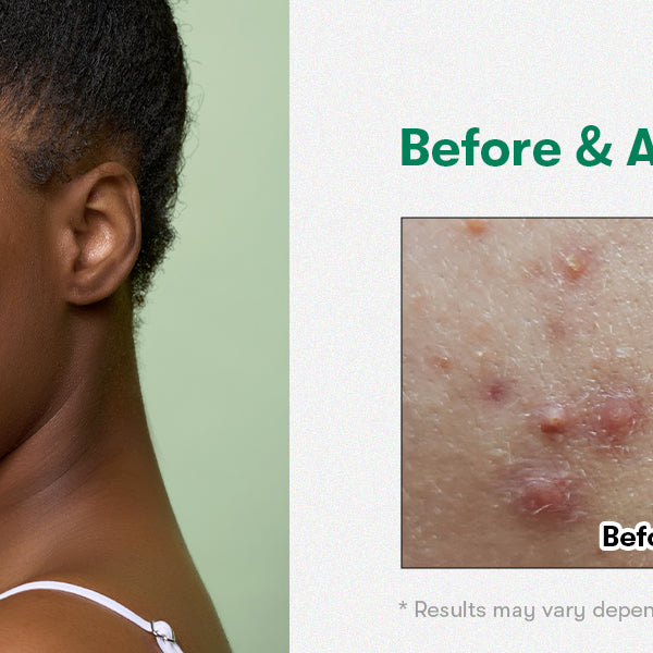 BE BEAUTY COSTA RICA