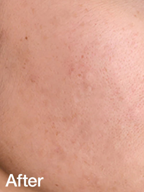 BE BEAUTY COSTA RICA