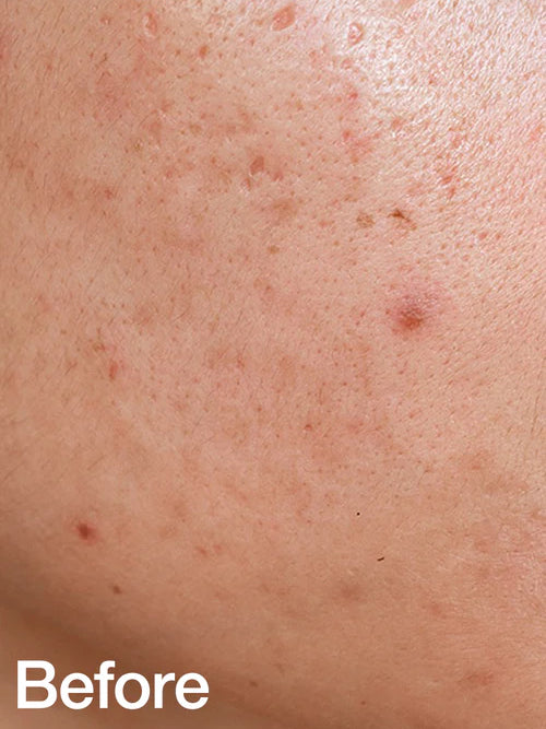 BE BEAUTY COSTA RICA