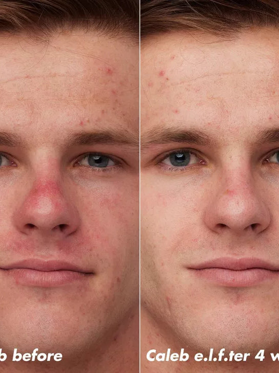 BE BEAUTY COSTA RICA