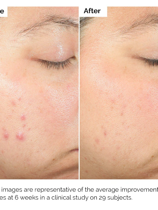 BE BEAUTY COSTA RICA