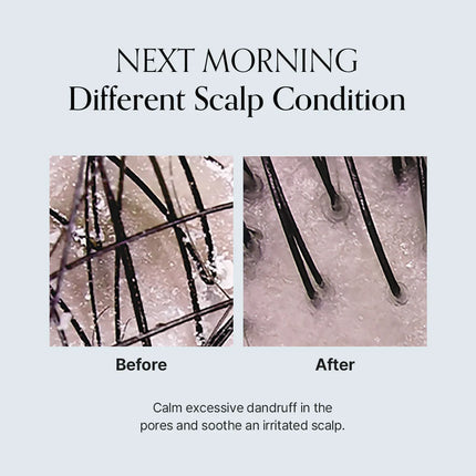 GROWUS  Damage Therapy Scalp Scaling Ampoule 50g