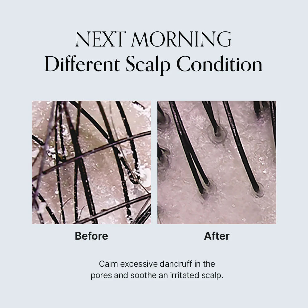 GROWUS  Damage Therapy Scalp Scaling Ampoule 50g