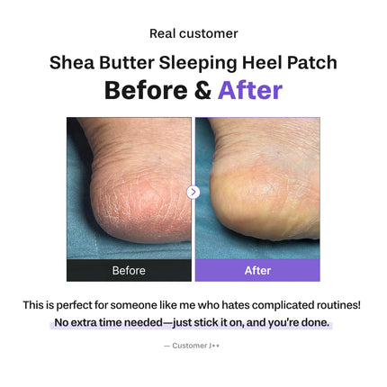 Baren Shea Butter Sleeping Heel Patch, 10pcs (5pares)