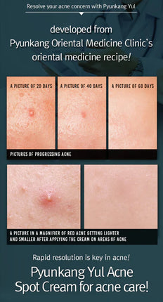 Pyunkang Yul - Crema antiacné Acne Spot Cream 15 ml