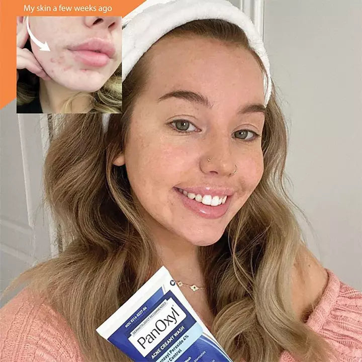 PanOxyl Acne Lavado Cremoso peróxido de benzoilo al 4%