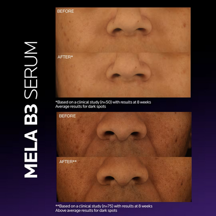 La Roche Posay Mela B3 Sérum Corrector de Manchas con Niacinamida