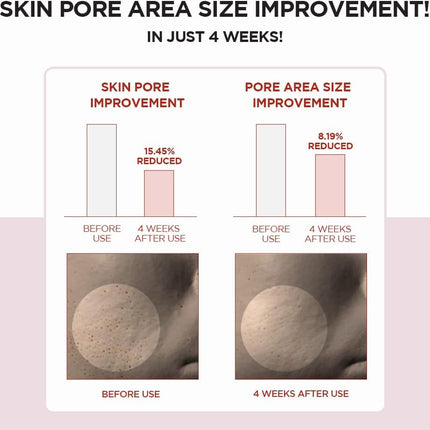 Skin1004 Centella Poremizing Tónico exfoliante y regulador del sebo 210ml