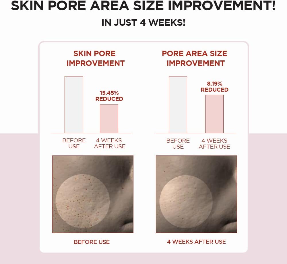 Skin1004 Centella Poremizing Tónico exfoliante y regulador del sebo 210ml