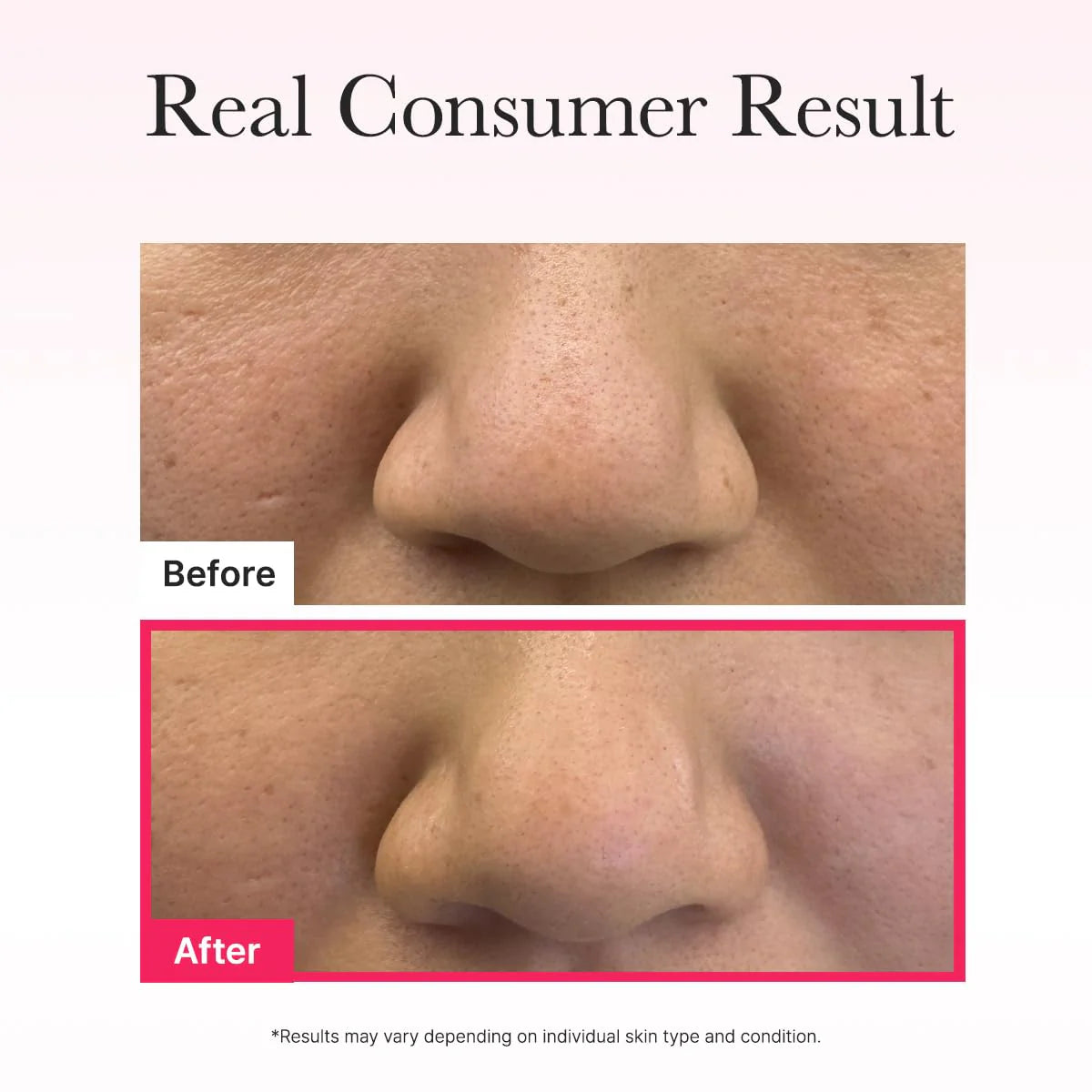 Arencia Red Collagen Jello Mask 25g*4EA