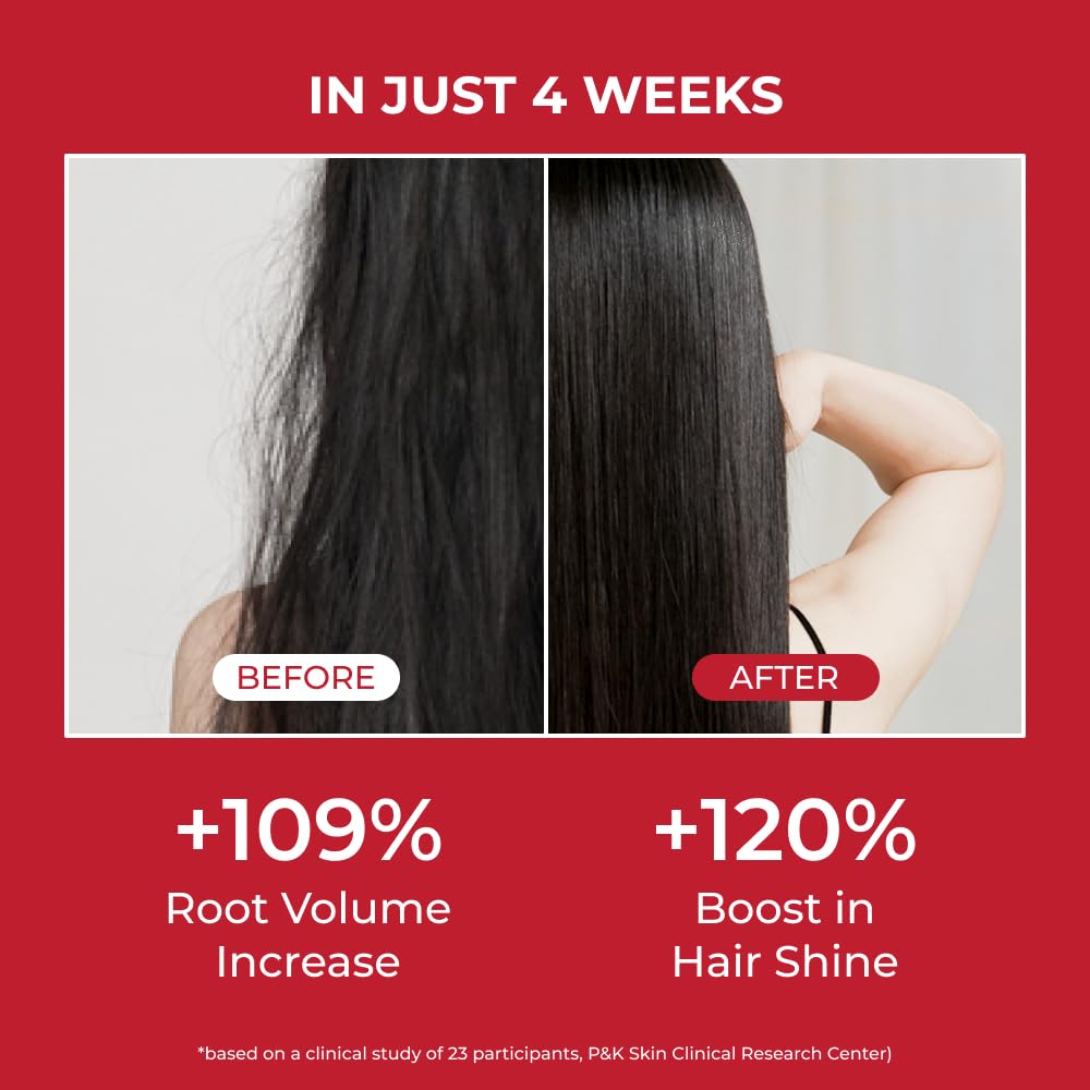 MOEV Shampoo ANNURCATIN  Cuidado del cabello de manzana coreana para mayor fuerza y volumen