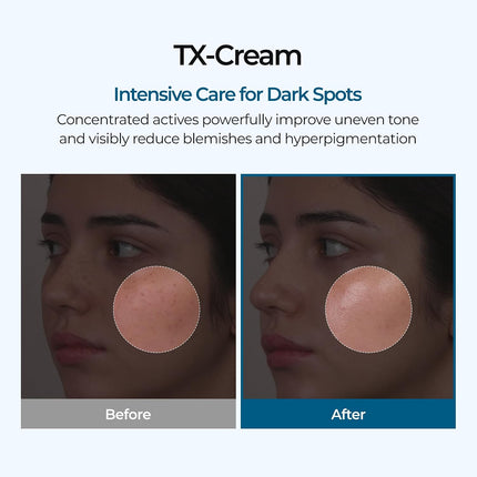 Dr. Melaxin TX Cream – Crema Iluminadora y Correctora de Manchas 50 g