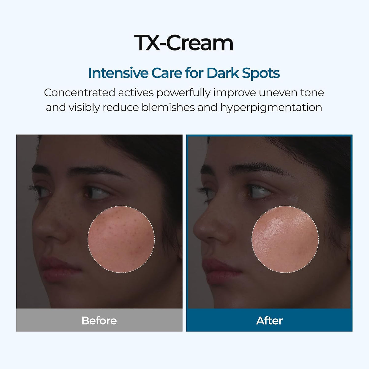 Dr. Melaxin TX Cream – Crema Iluminadora y Correctora de Manchas 50 g
