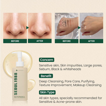 K-Secret Seoul 1988 Aceite Limpiador – Pine Cica 1% + Probióticos 150 ml