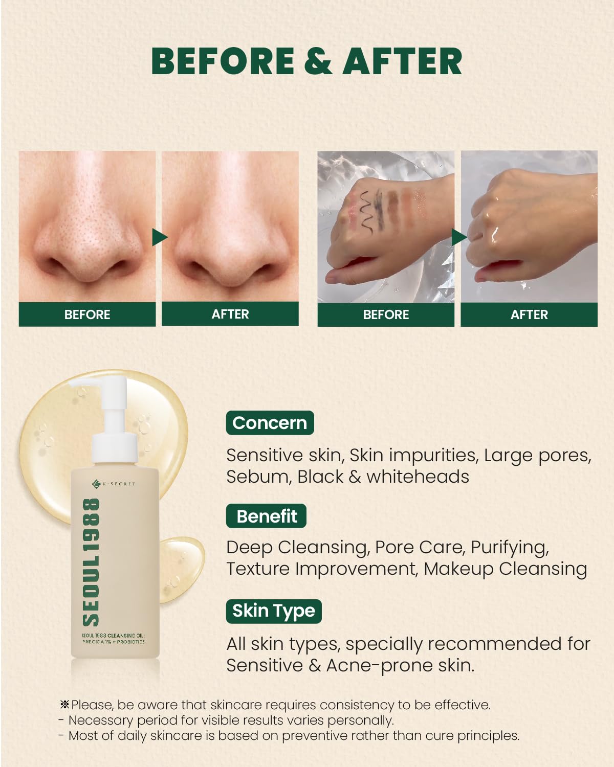 K-Secret Seoul 1988 Aceite Limpiador – Pine Cica 1% + Probióticos 150 ml