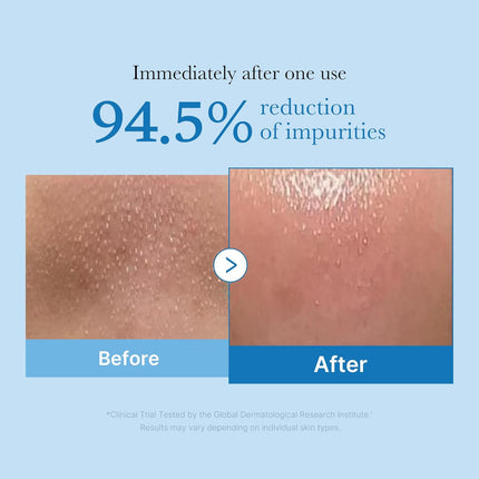 Medicube Zero Pore Blackhead Deep Cleansing Oil 200ml