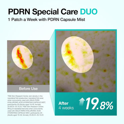 ANUA PDRN Collagen Melting Patch for Glass Skin – Parches de Colágeno y PDRN para Líneas de Expresión