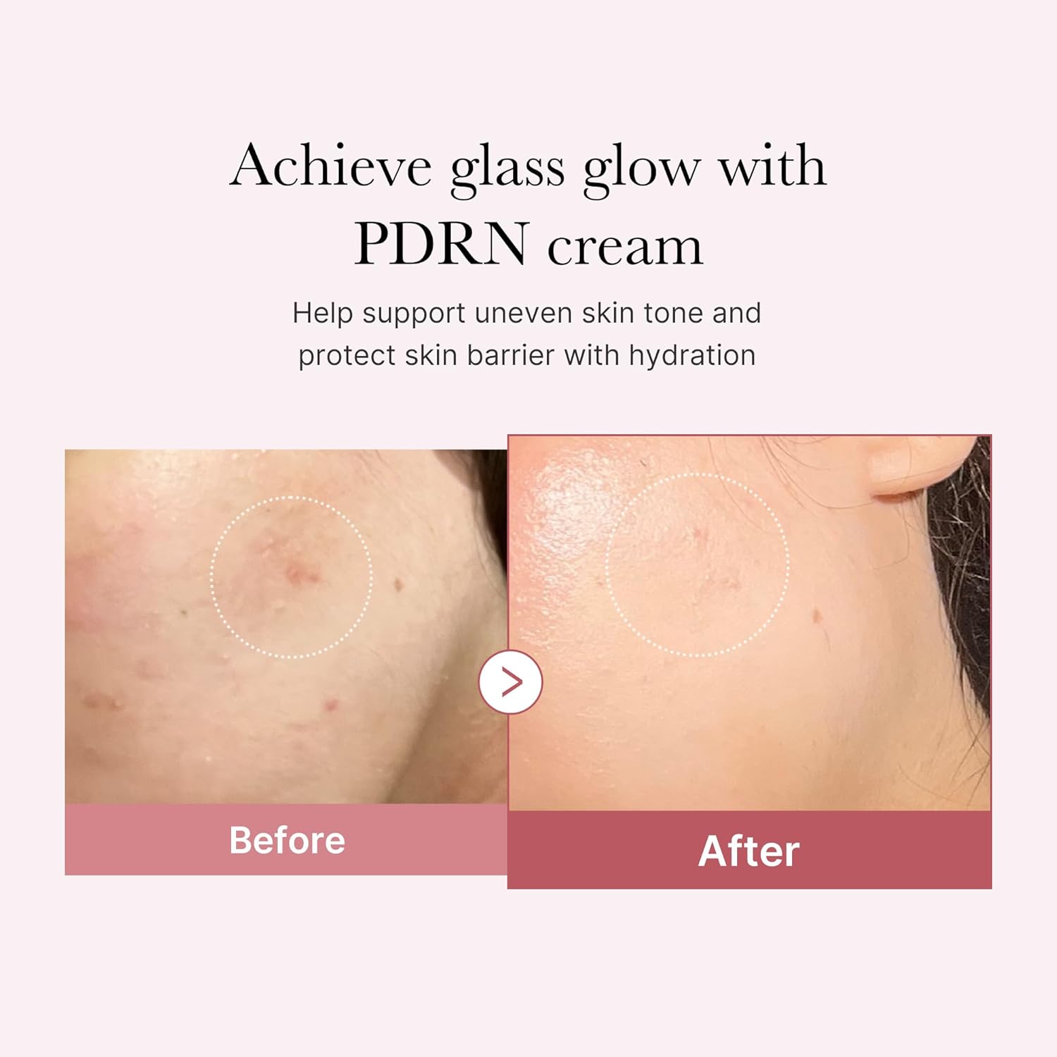 PDRN Pink Hyaluronic Moisturizing Cream Medicube 50ml
