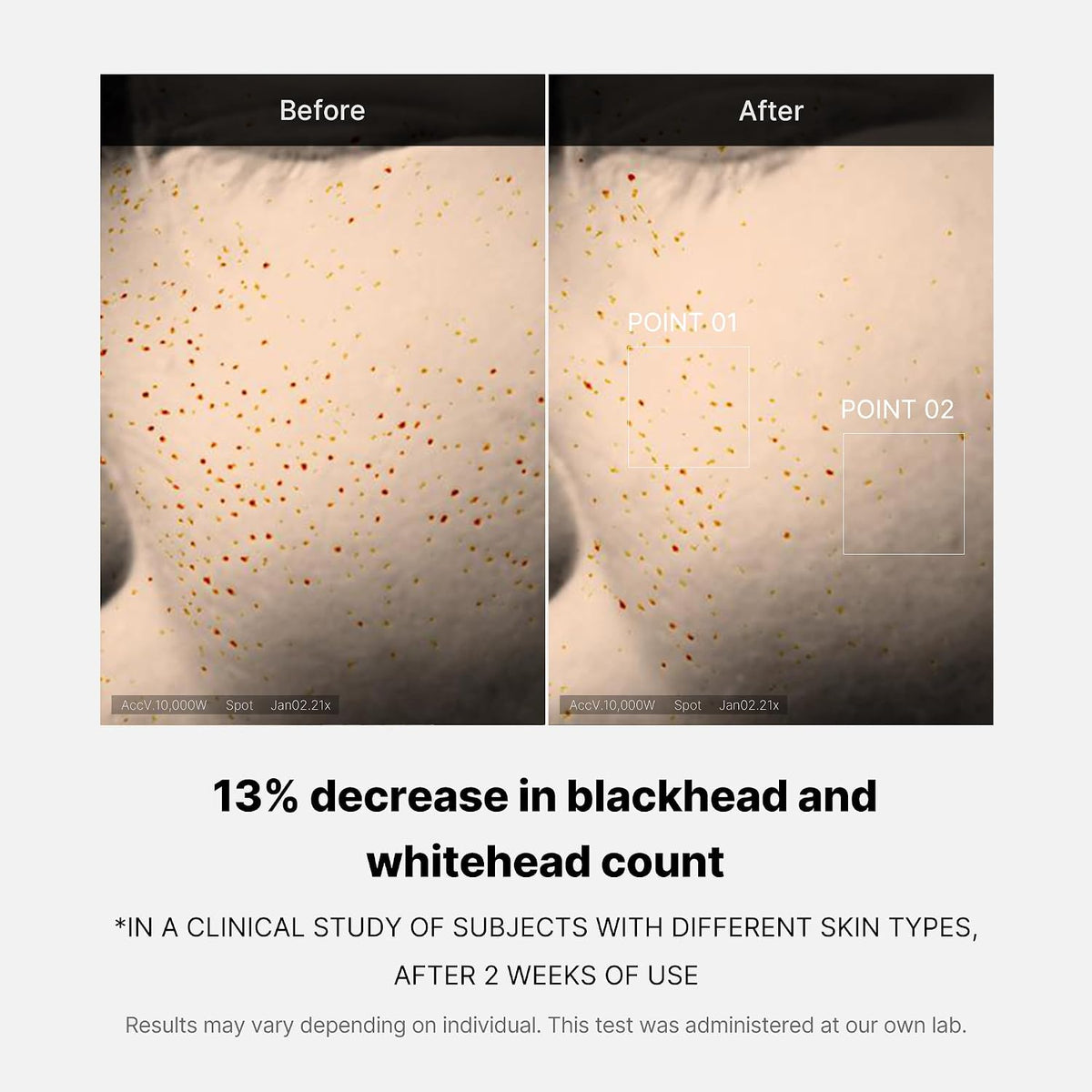 Medicube Zero Pore One Day peptide serum Suero exfoliante y reafirmante de poros