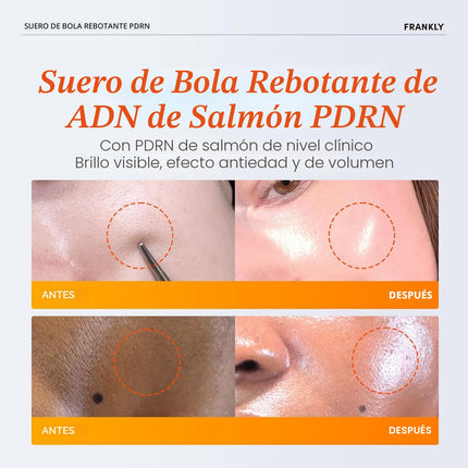 FRANKLY Salmon PDRN Bounce Ball Serum – Sérum Reafirmante PDRN de Salmón 30 ml