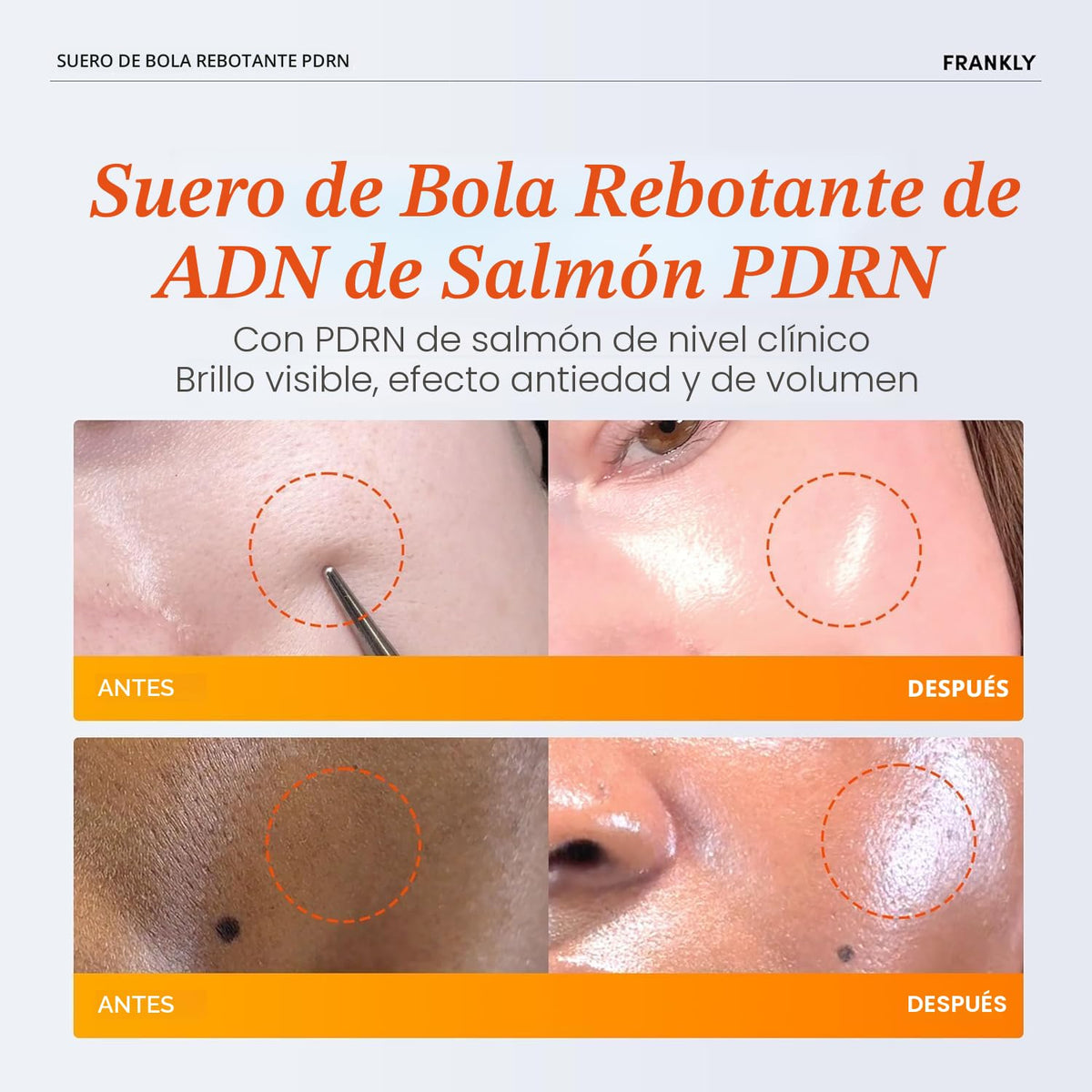 FRANKLY Salmon PDRN Bounce Ball Serum – Sérum Reafirmante PDRN de Salmón 30 ml