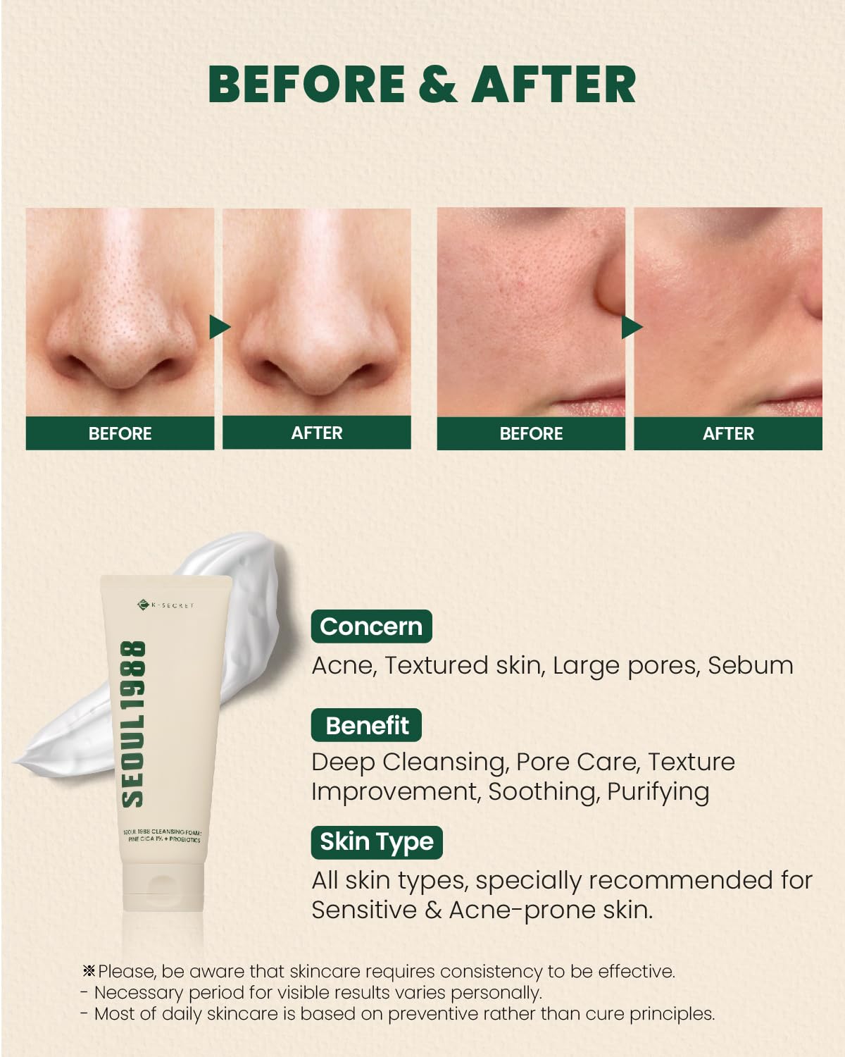 KSECRET Espuma limpiadora: Pino Cica 1% + Probióticos 150ml