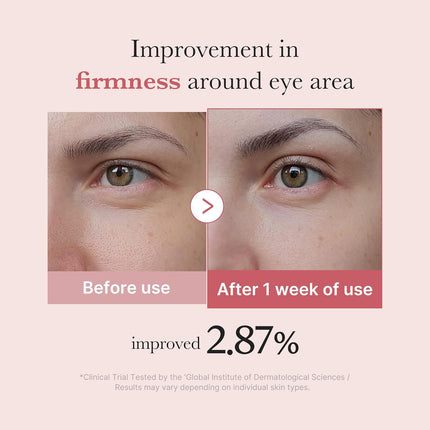 Medicube - PDRN Pink Peptide Eye Cream 30ml