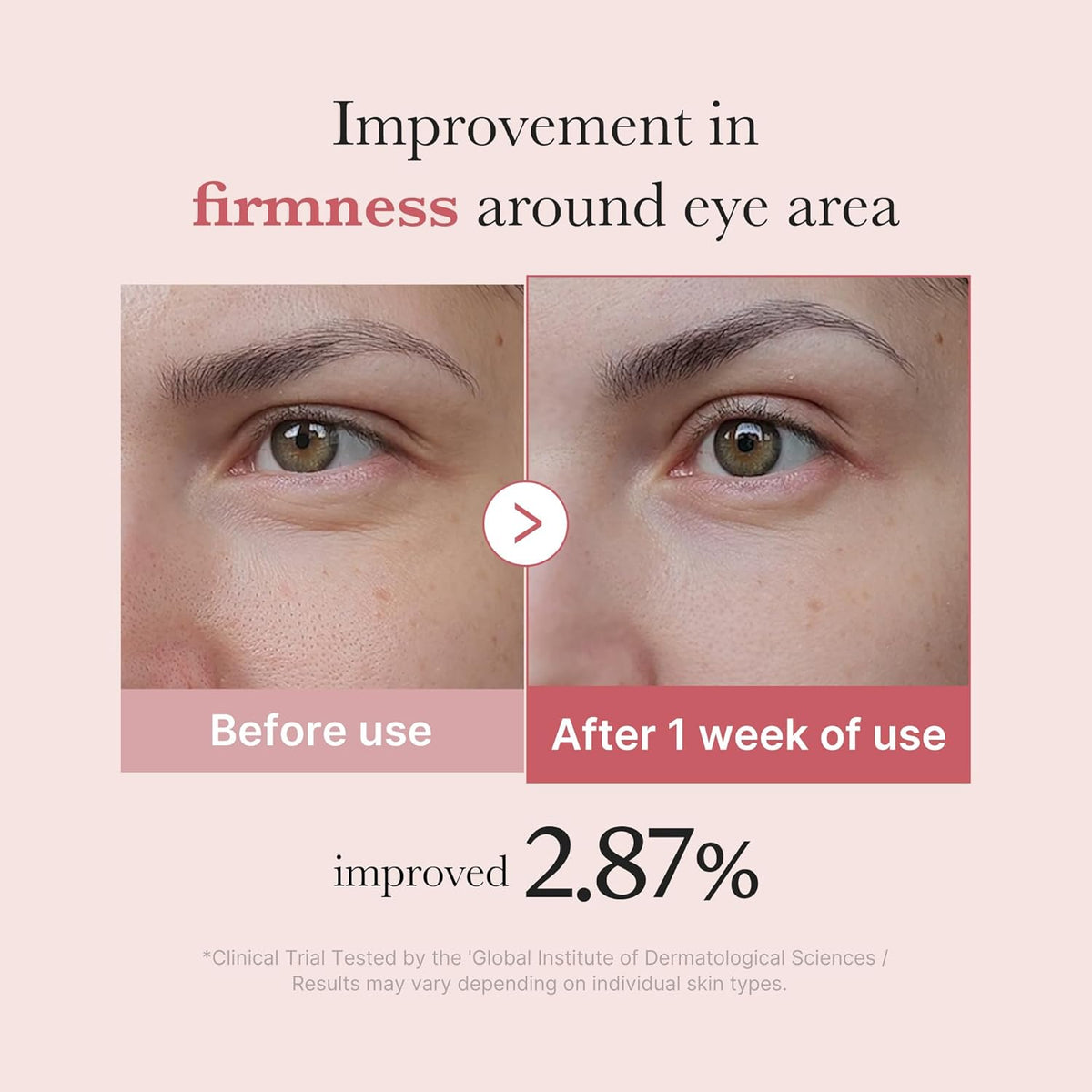 Medicube - PDRN Pink Peptide Eye Cream 30ml