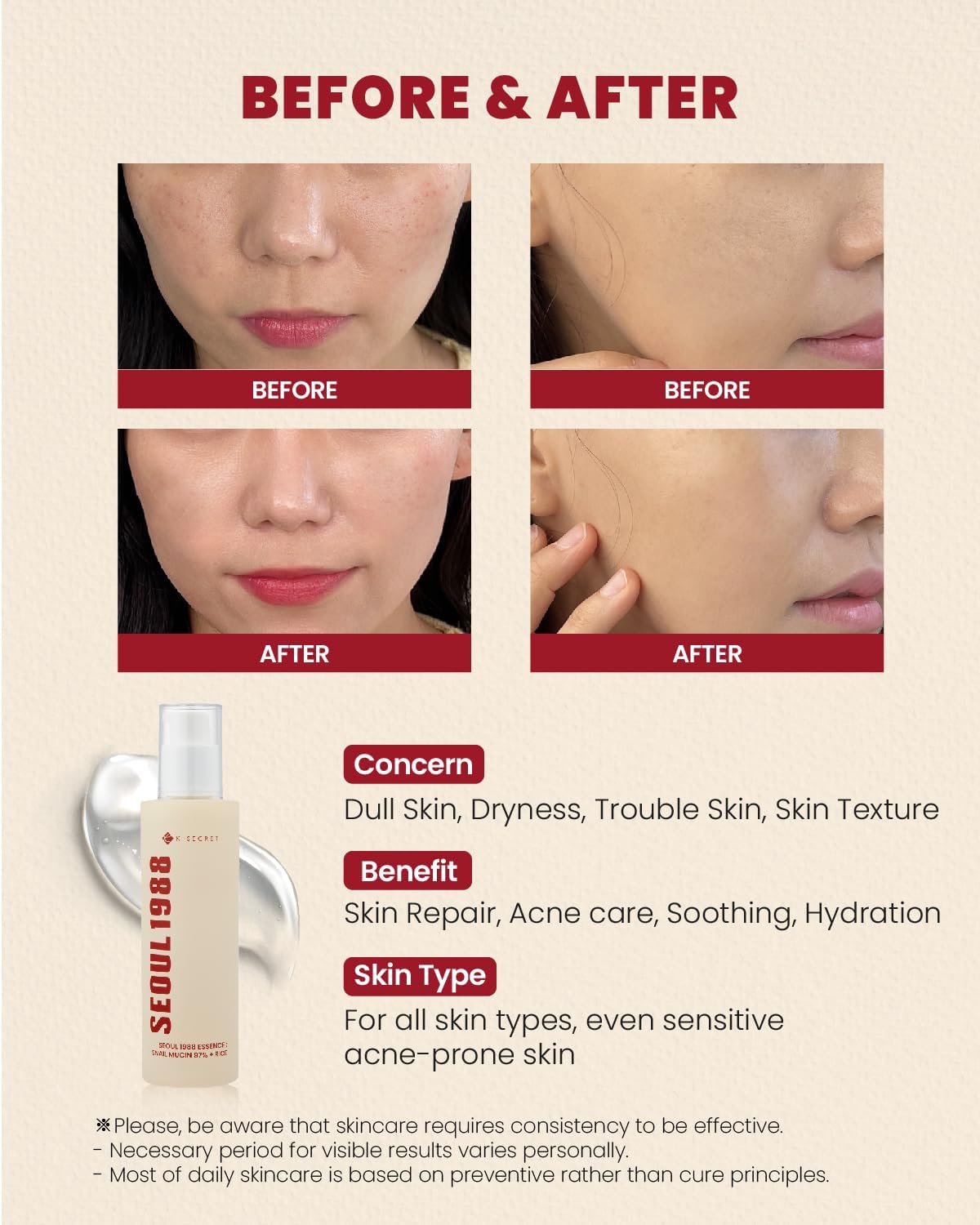 KSECRET SEOUL 1988 Essence : Snail Mucin 97% + Rice 100ml