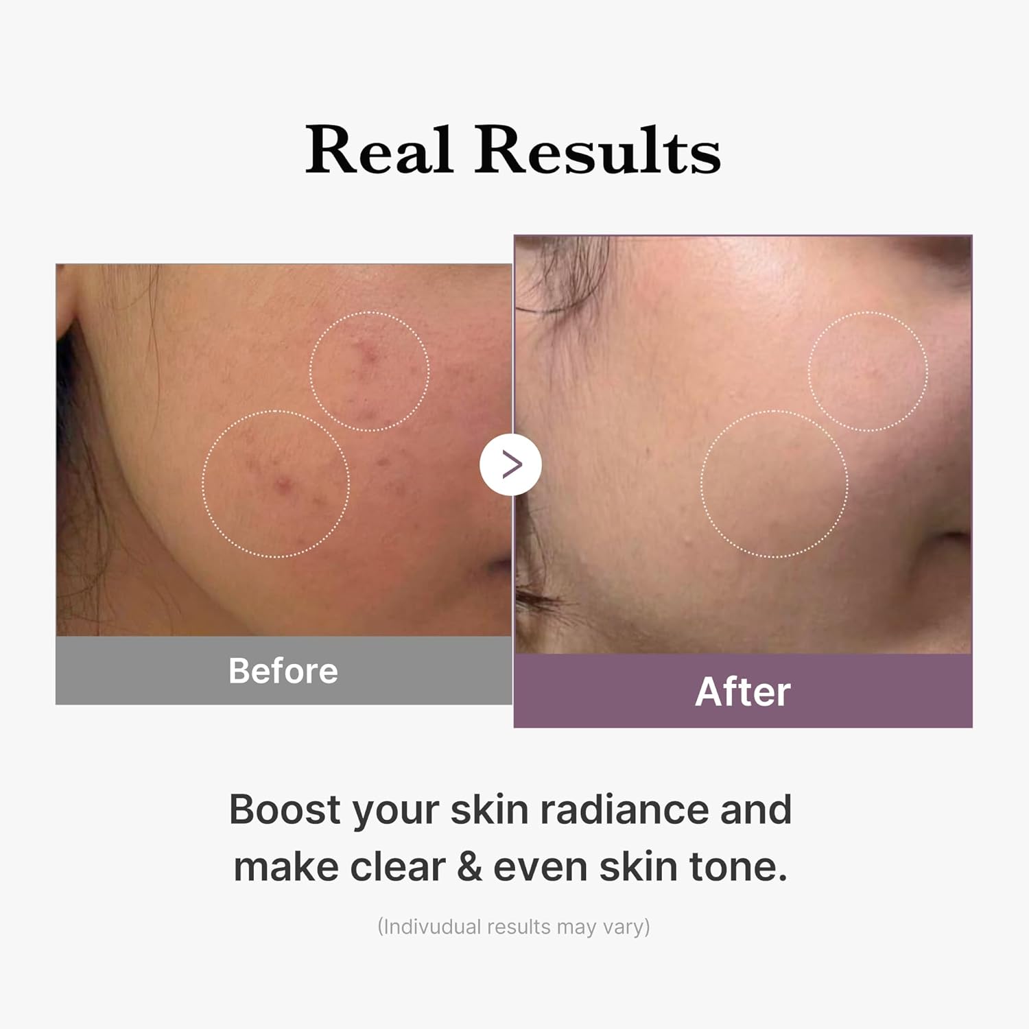 Medicube AGE-R Glutathione Glow Toner – Tónico lechoso para una piel radiante y uniforme