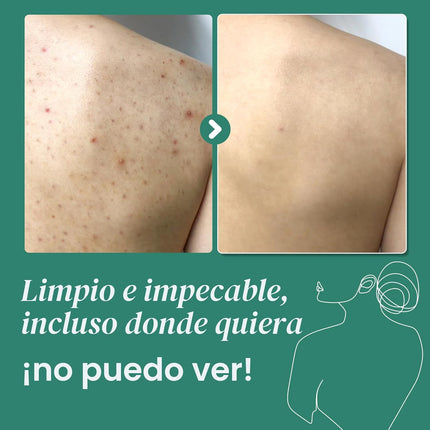 Some by Me AHA.BHA.PHA 30 Days Miracle Clear Body Cleanser 400g
