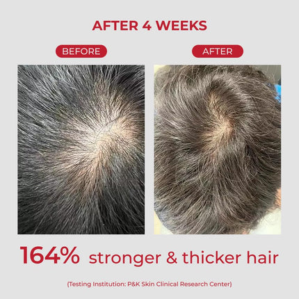 MOEV Champú ANNURCATIN 300ml Cuidado del cabello de manzana coreana para mayor fuerza y volumen