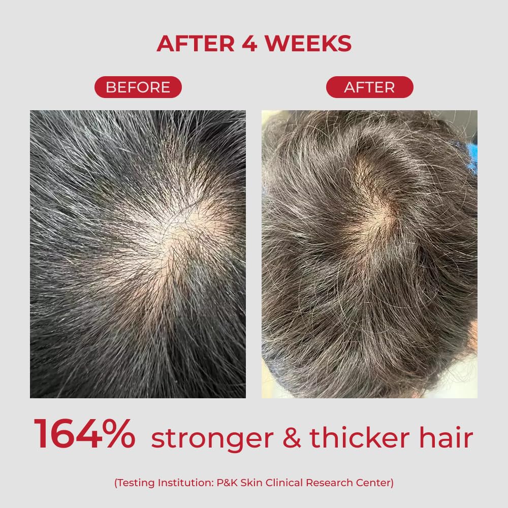 MOEV Shampoo ANNURCATIN  Cuidado del cabello de manzana coreana para mayor fuerza y volumen