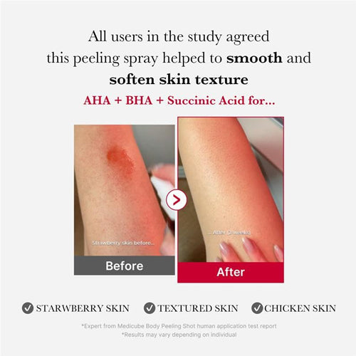 Medicube Red Acne Body Peeling Shot – 110g
