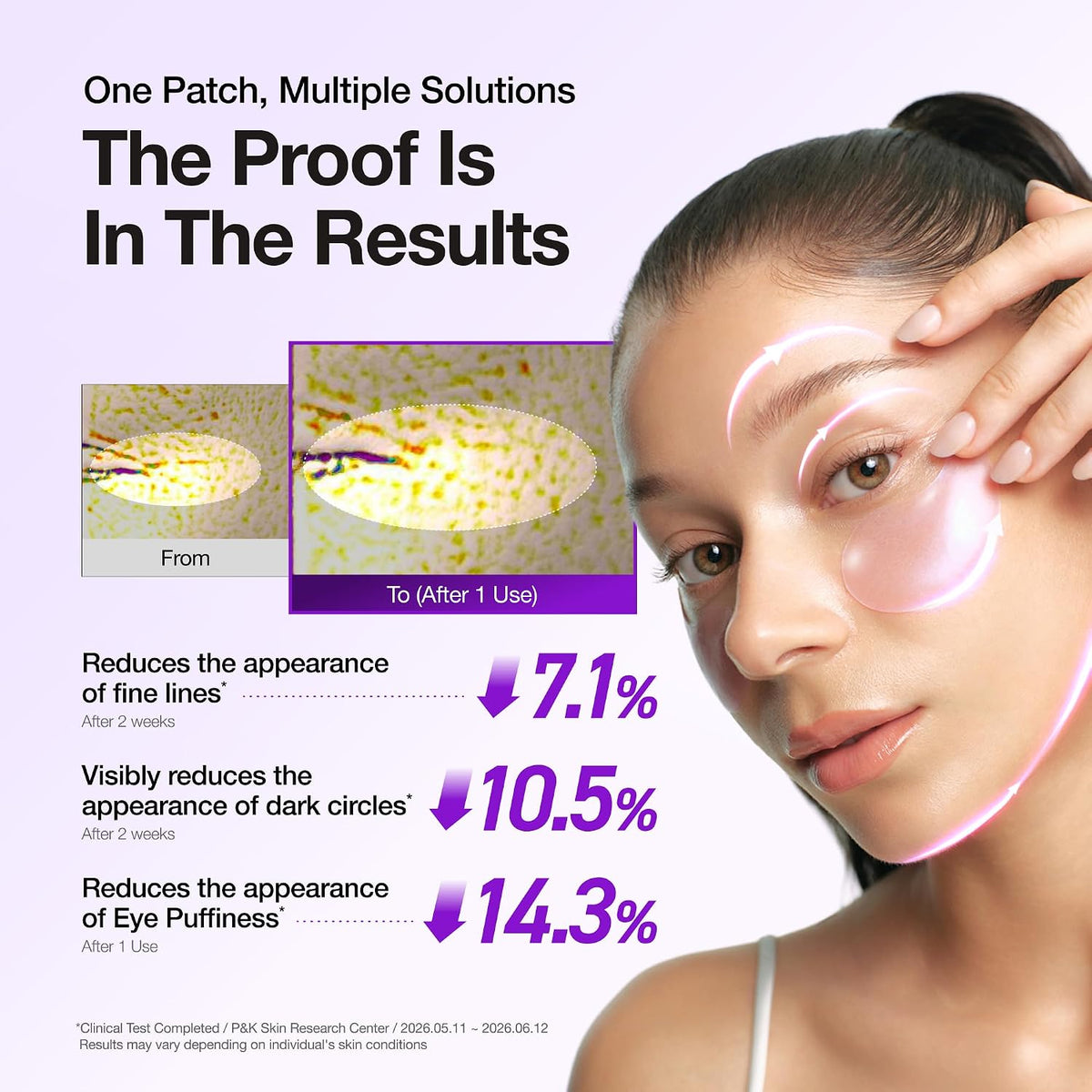 ANUA Retinol Berry Eye Patches – 60 unidades