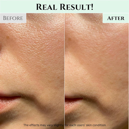 Beauty of Joseon Green Plum Refreshing limpiador profundo de poros, lavado facial para acné, removedor de puntos negros