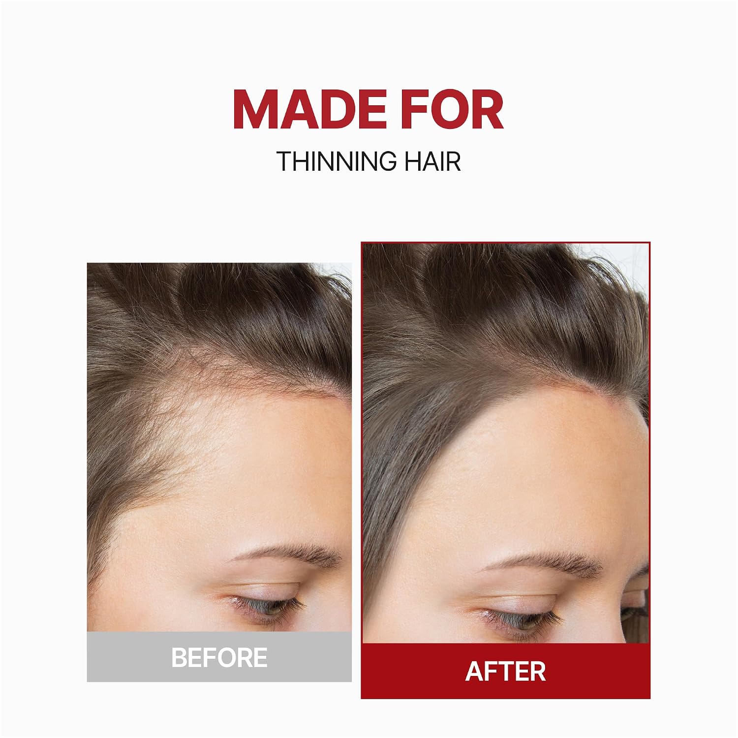 KUNDAL Head Spa & Scalp Care+ Scalp Tonic – Tónico Capilar con Cafeína 100 ml