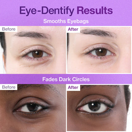 Numbuzin Parches de colágeno NAD+ n.° 9 para el contorno de ojos (5 pares)