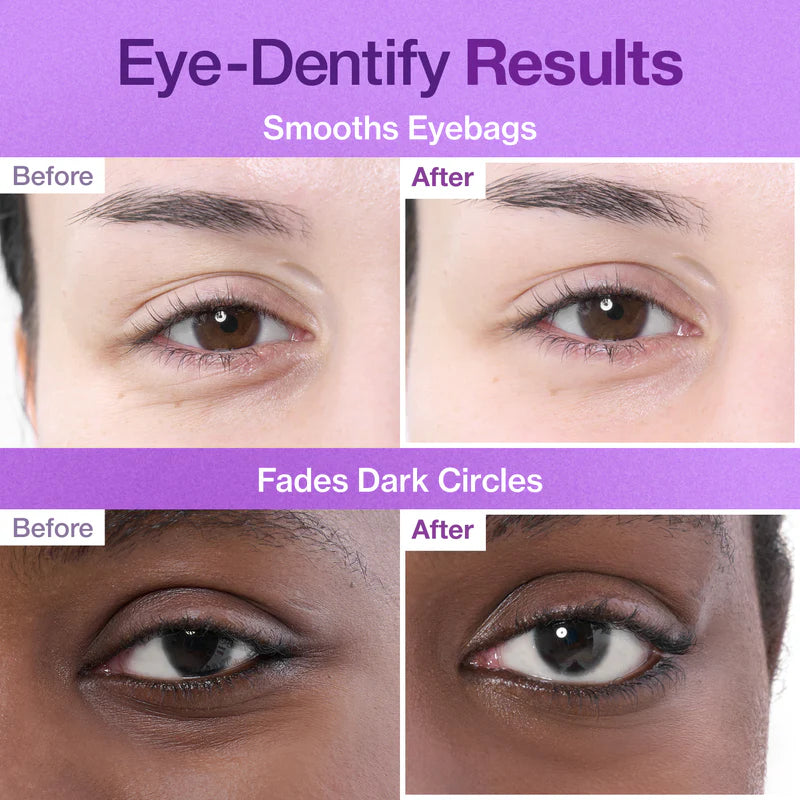 Numbuzin Parches de colágeno NAD+ n.° 9 para el contorno de ojos (5 pares)
