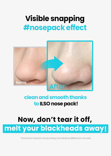ilso Natural Mild Clear Nose Pack 5 sets