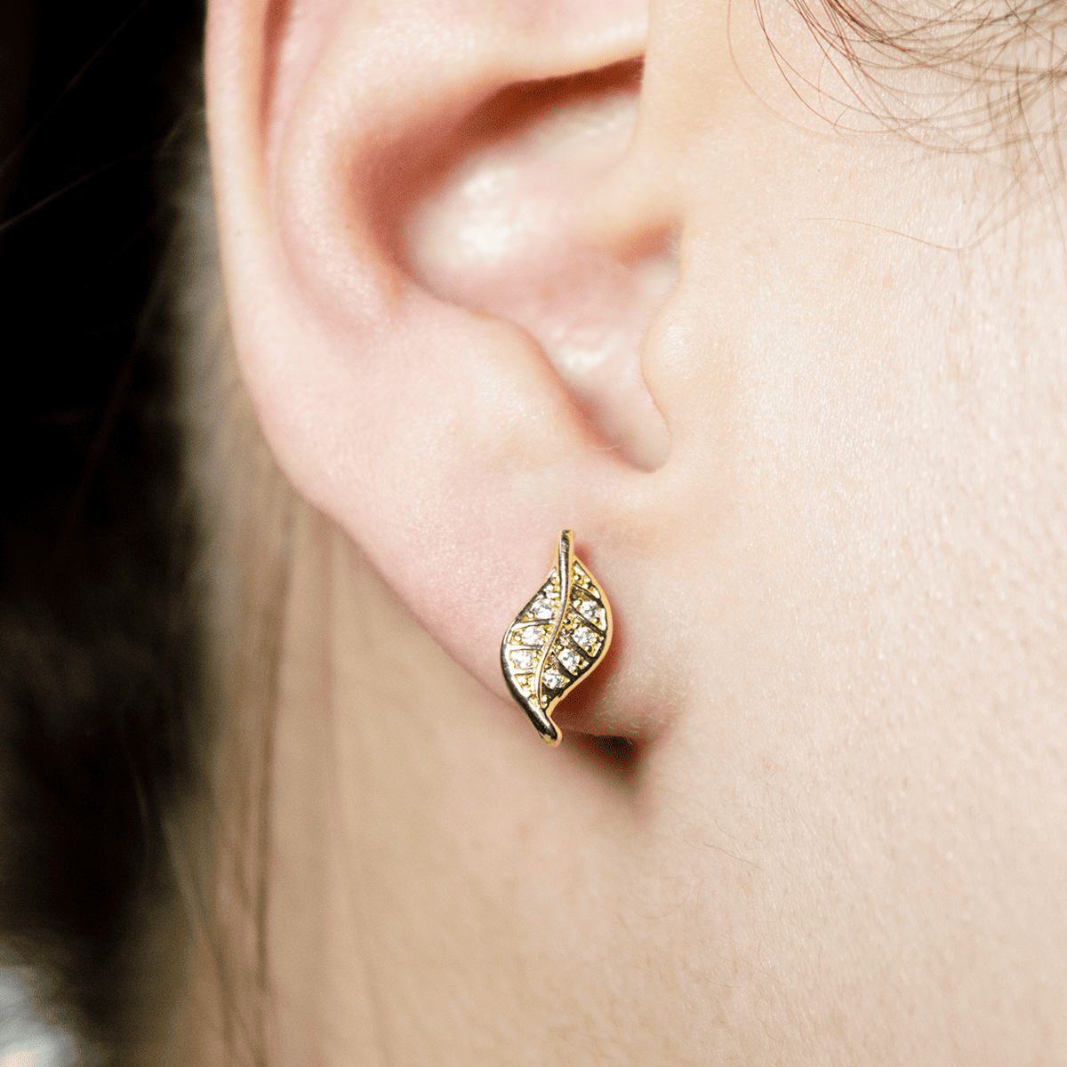 Mix Aretes (Topos)