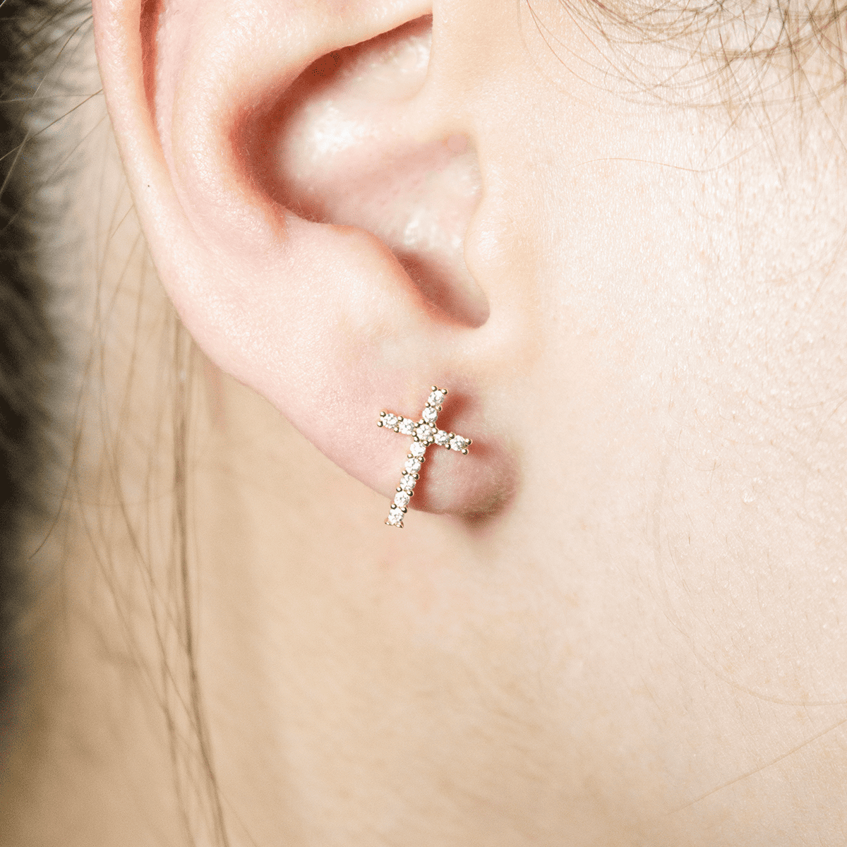 Mix Aretes (Topos)