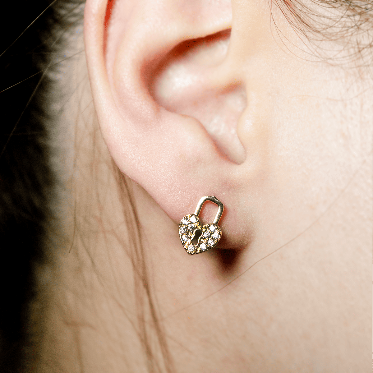 Mix Aretes (Topos)