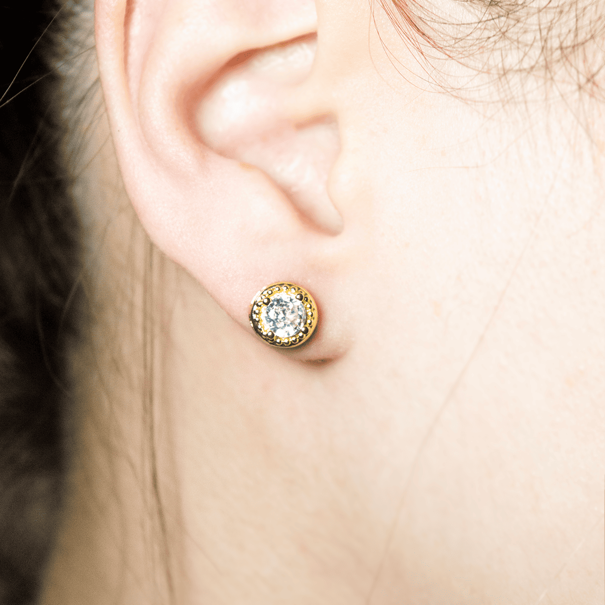 Mix Aretes (Topos)