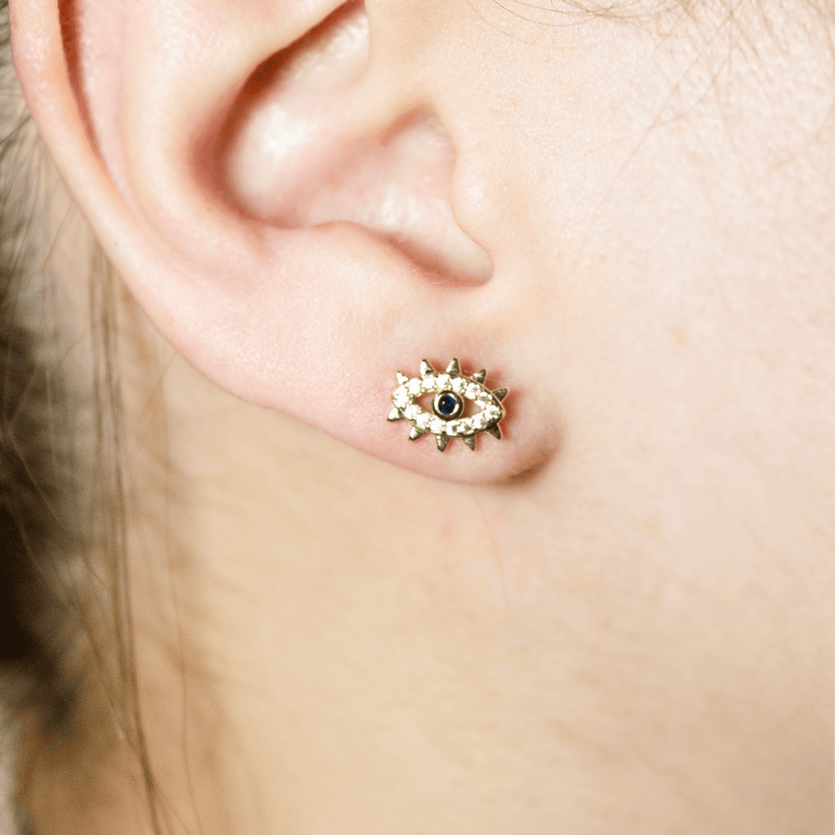 Mix Aretes (Topos)