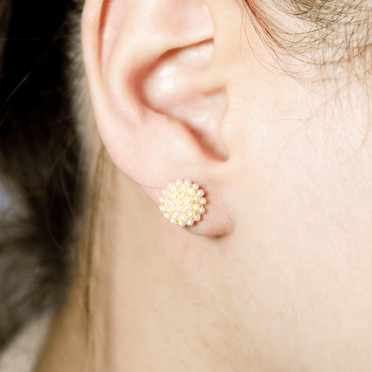 Mix Aretes (Topos)