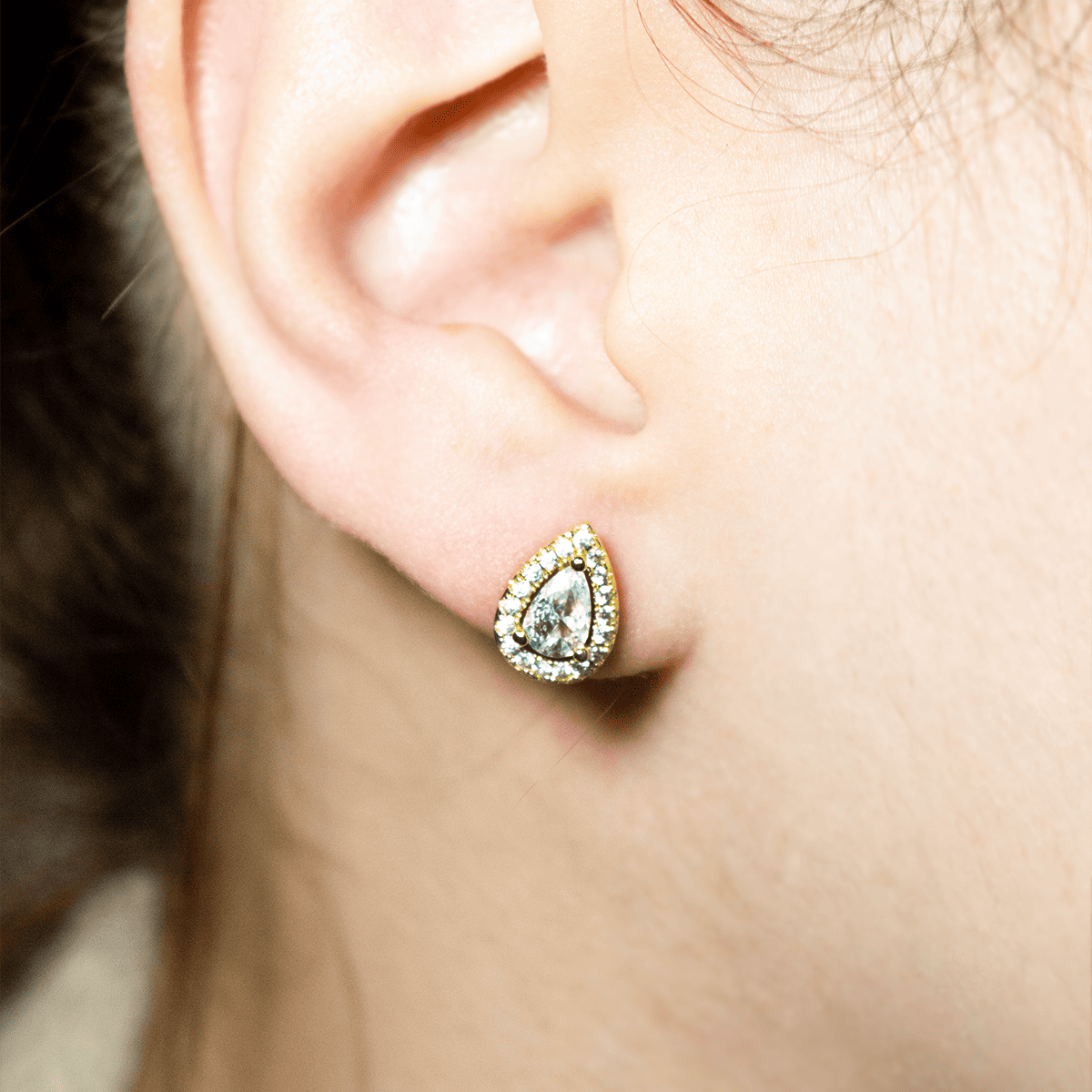 Mix Aretes (Topos)