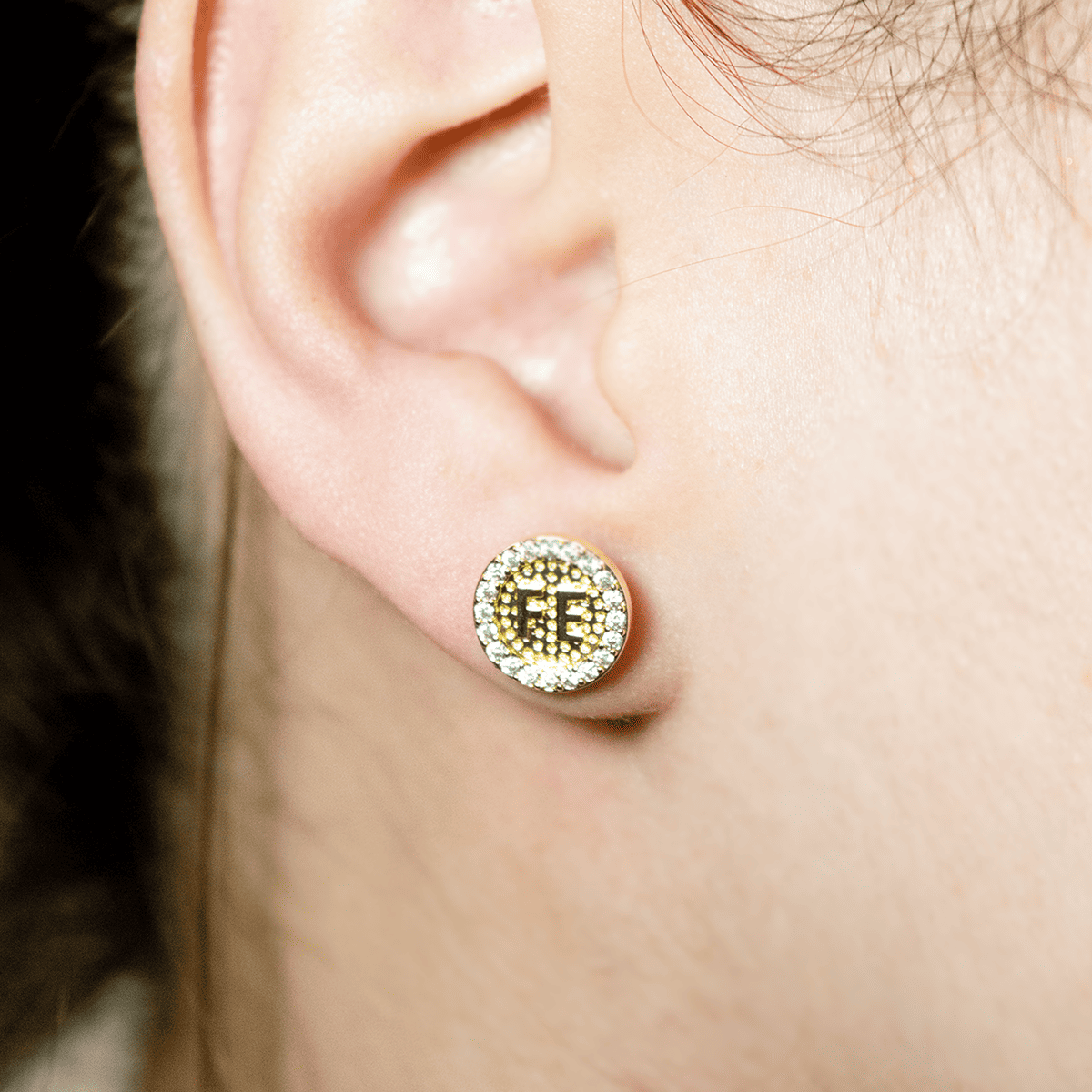 Mix Aretes (Topos)
