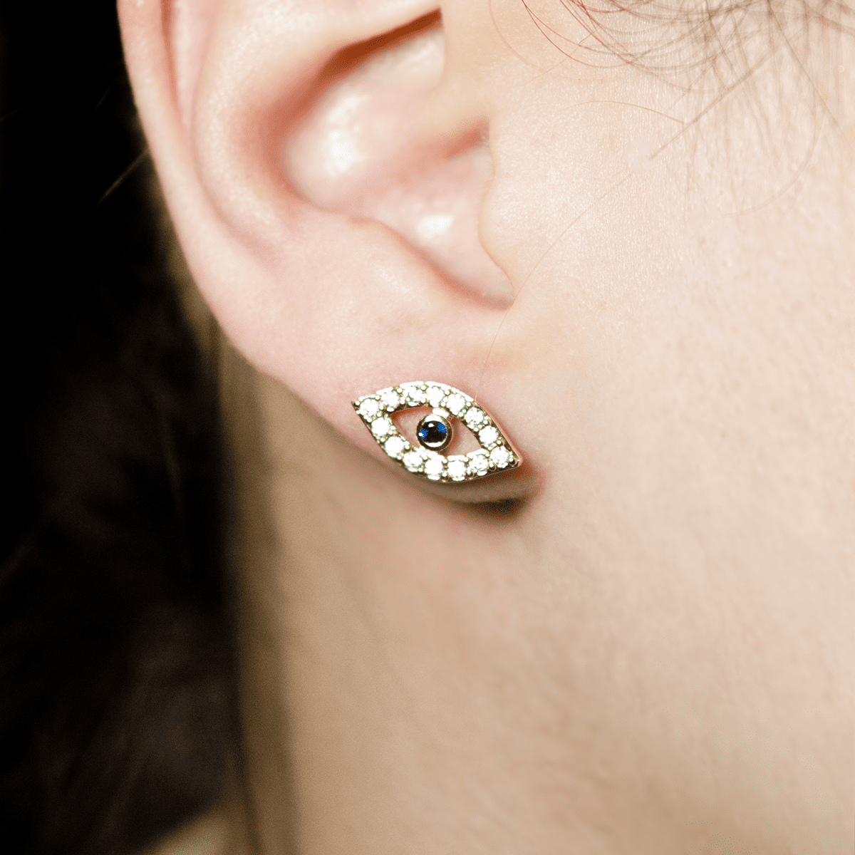 Mix Aretes (Topos)