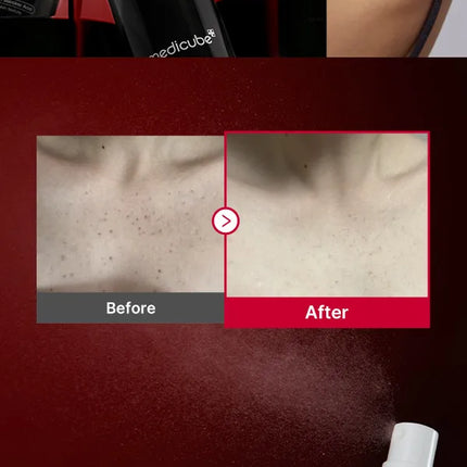 Medicube Red Acne Body Peeling Shot – 110g